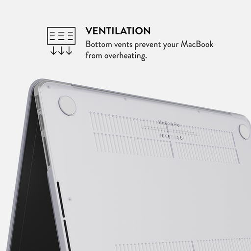 Sunday Brunch - Macbook Case 19