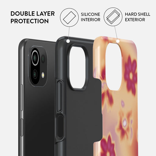 Divine - Xiaomi Mi 11 Lite 4G / 5G Case 2