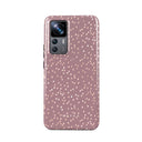 Hot Cocoa - Spotted Xiaomi 12T Case 1