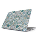 Tropical Oasis - Macbook Case 1