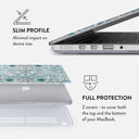 Tropical Oasis - Macbook Case 18