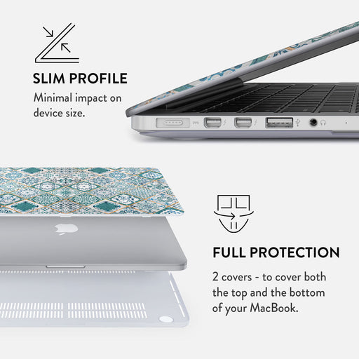 Tropical Oasis - Macbook Case 18