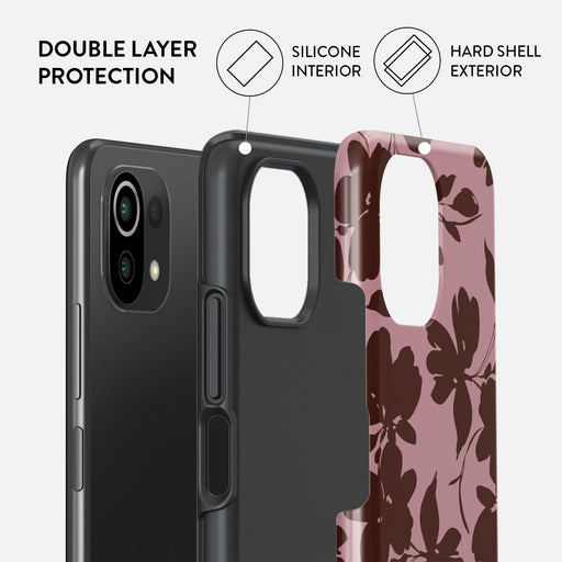 Gossip - Xiaomi 11 Lite 5G NE Case 2