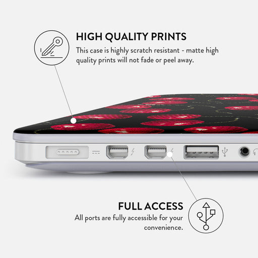 Cherrybomb - Macbook Case 20