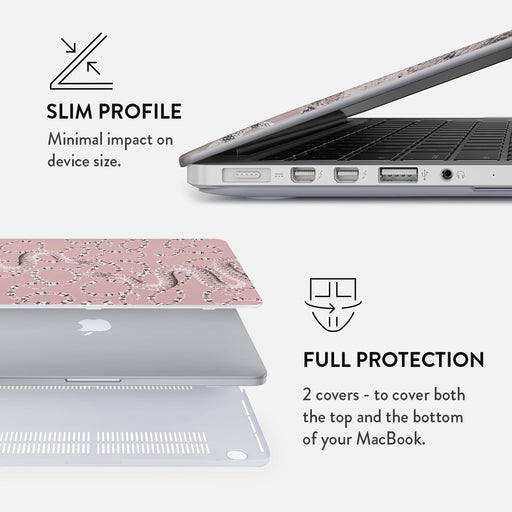 Poolside Glam - Macbook Case 18