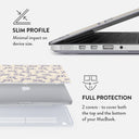 Derby Race - Macbook Case 18
