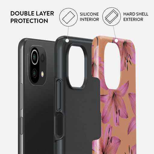 Eden - Xiaomi Mi 11 Lite 4G / 5G Case 2