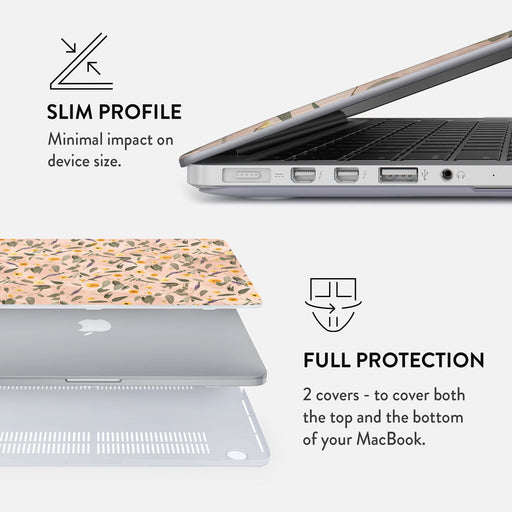 Sunday Brunch - Macbook Case 18