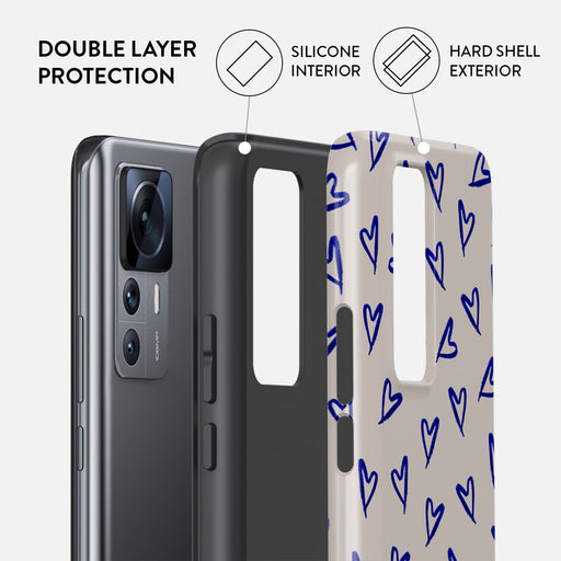 Love Me Right - Xiaomi 12T Case 2