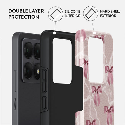 Ballerina -Xiaomi 14T Case 2