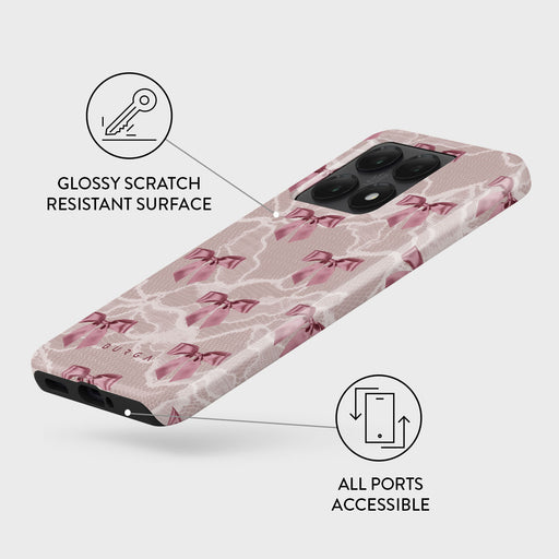Ballerina -Xiaomi 14T Case 3