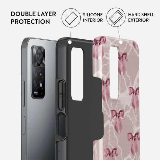 Ballerina - Xiaomi Redmi Note 11 Pro+ Case 2