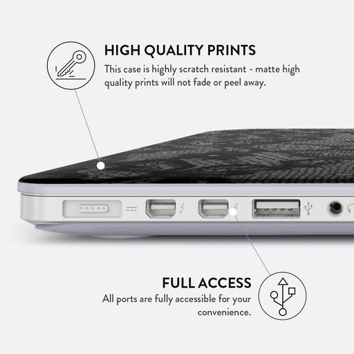 Magnetic - Macbook Case 20