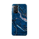 Blue Lagoon - Xiaomi Redmi Note 11 Pro+ Case 1