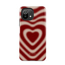 Sweet Affair - Xiaomi Mi 11 Lite 4G / 5G Case 1