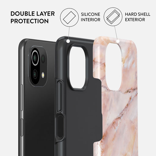Morning Sunshine - Pastel Marble Xiaomi Mi 11 Lite 4G / 5G Case 2